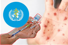 México está a punto de perder la certificación de país libre de sarampión de la OMS