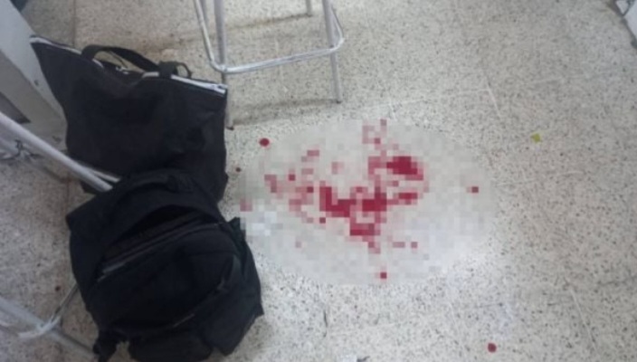 Alumno apuñala a maestro en secundaria de Huimanguillo, Tabasco; lo reportan grave