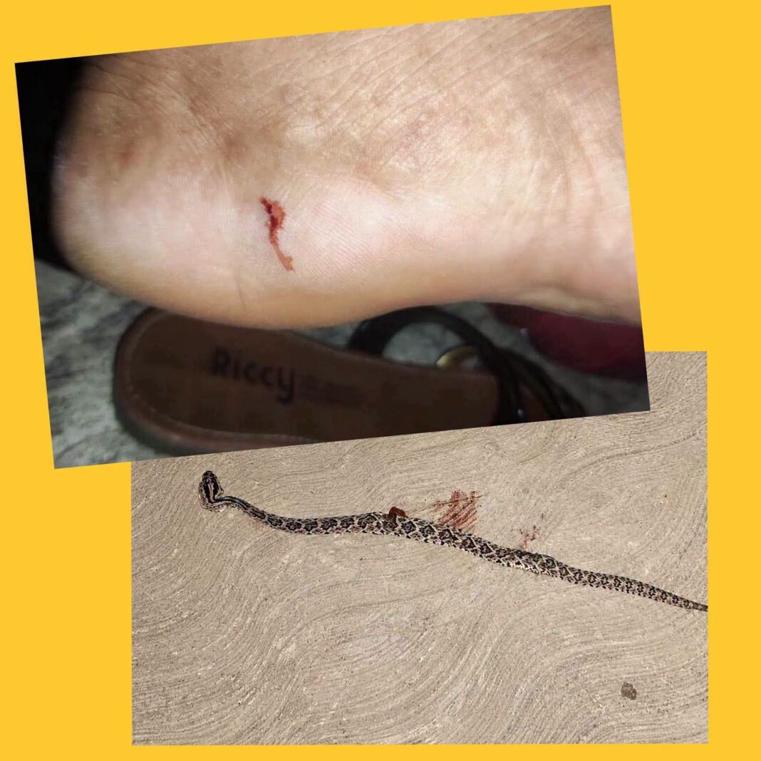 En labores domésticas ,mujer es mordida por serpiente de cascabel en su predio en comisaria de Mérida En labores domésticas ,mujer es mordida por serpiente de cascabel en su predio en comisaria de Mérida