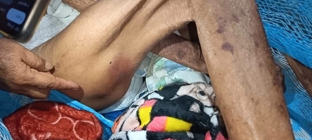 Adulta mayor de 88 años requiere ayuda urgente; piden intervención de autoridades y apoyo ciudadano en Mérida Adulta mayor de 88 años requiere ayuda urgente; piden intervención de autoridades y apoyo ciudadano en Mérida