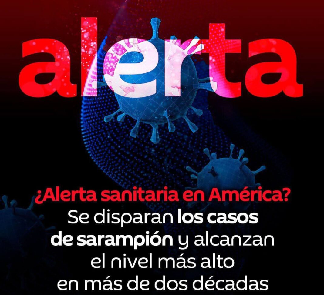 OPS alerta por repunte de sarampión: América registra su peor cifra en 22 años OPS alerta por repunte de sarampión: América registra su peor cifra en 22 años