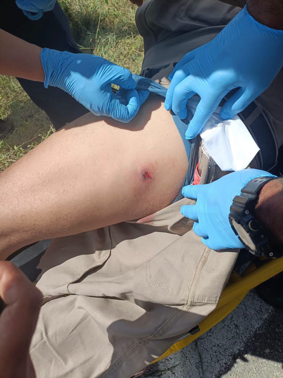Motociclista lesionado al recibir disparos de balines en carretera Tizimin-Río Lagartos Motociclista lesionado al recibir disparos de balines en carretera Tizimin-Río Lagartos