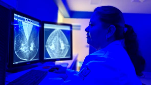Orienta IMSS Yucatán sobre autoexploración mamaria fundamental en detección oportuna de cáncer de mama Orienta IMSS Yucatán sobre autoexploración mamaria fundamental en detección oportuna de cáncer de mama